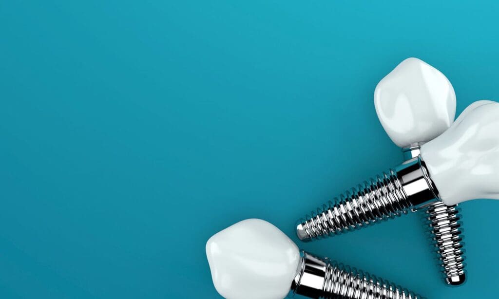 Dental Implants in Carpentersville, IL