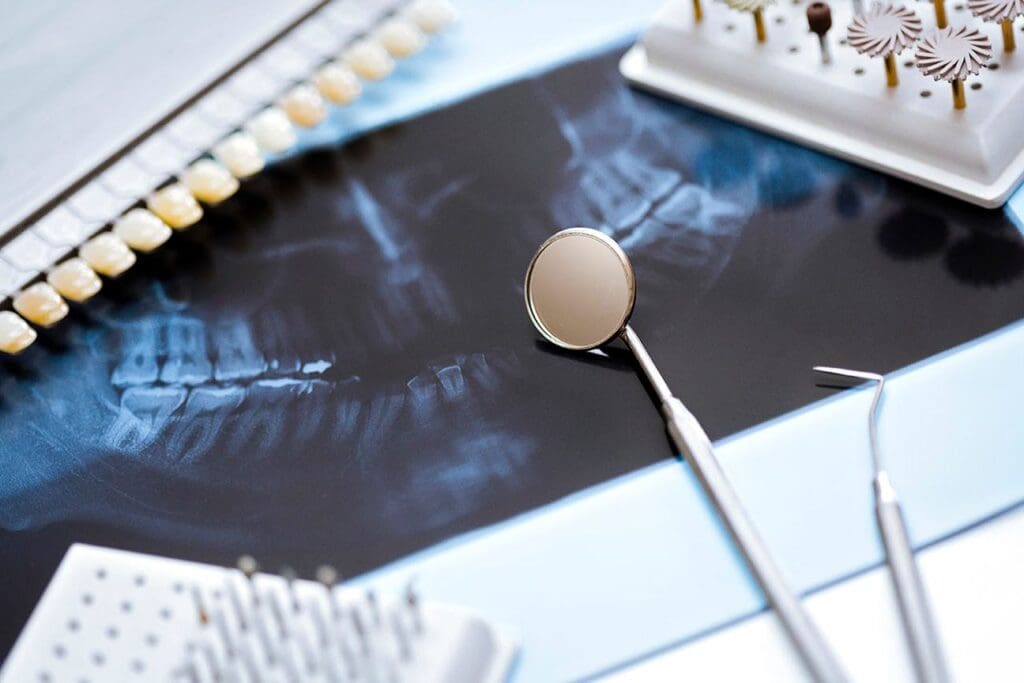 Dental Services in Allentown, PA