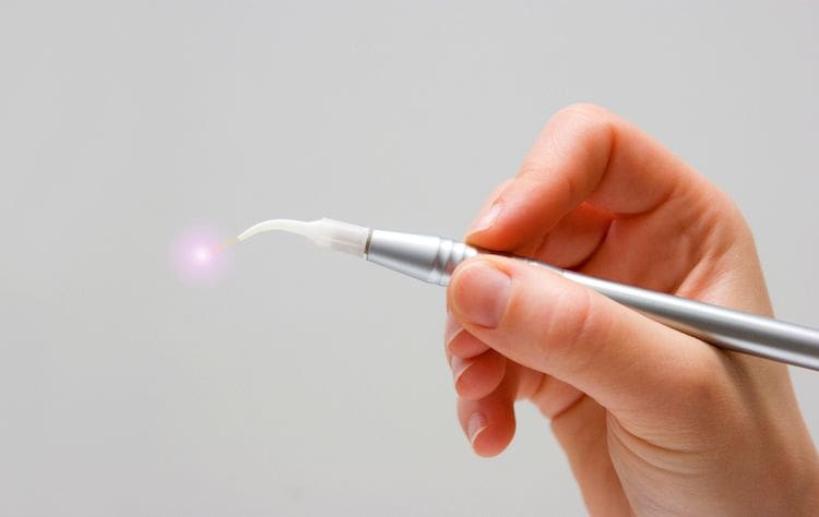 Laser Dentistry in Crystal Lake, IL
